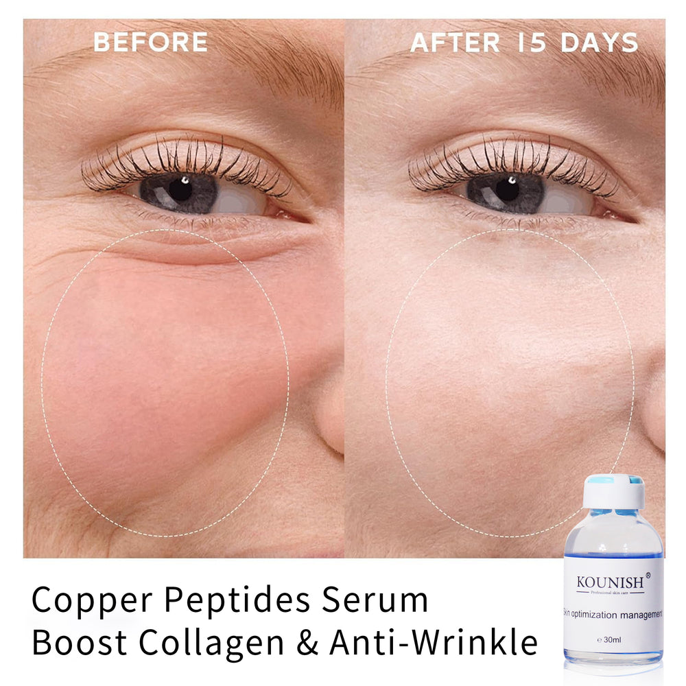 Copper Peptide GHK–Cu Glow Serum – KOUNISH