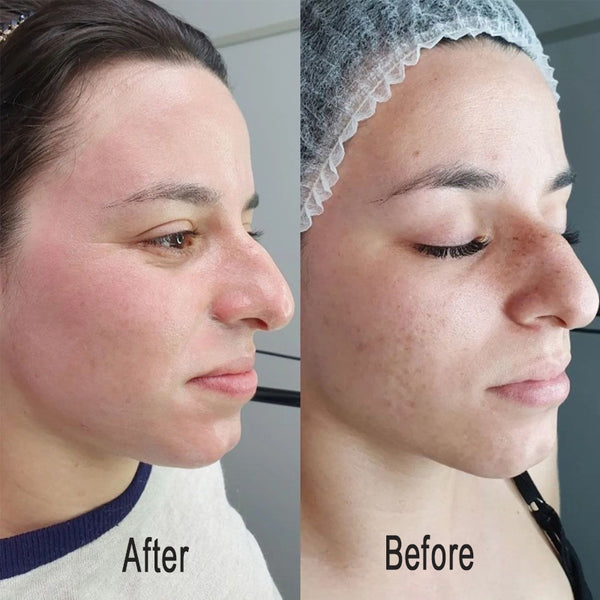 Radiant BB Glow Skin Kit